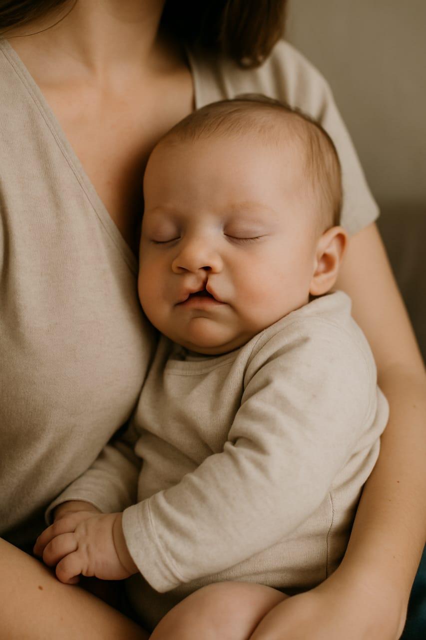 Santa Isabel: cirurgia para lábio leporino e fenda palatina passa a ser obrigatória pelo SUS em todo o país