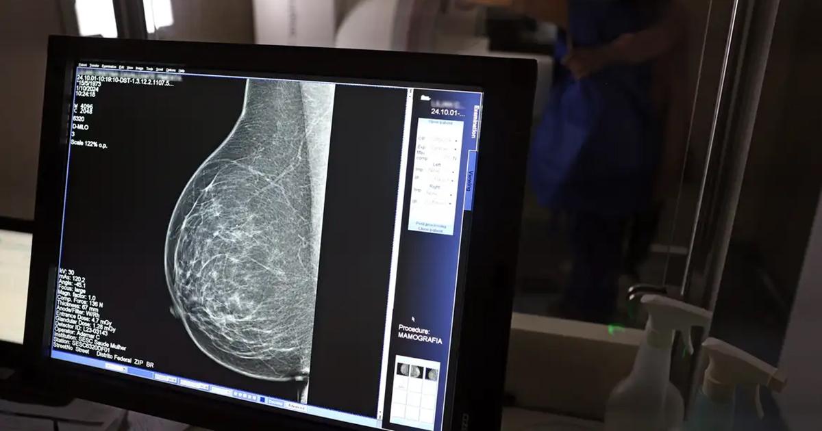 SUS em Santa Isabel passa a oferecer mamografia para mulheres na faixa dos 40 anos